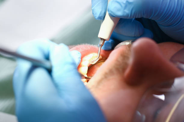Emergency Dentist Open Today in MA